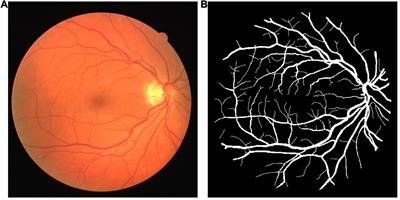 Real-Time Cerebral Vessel Segmentation in Laser Speckle Contrast Image Based on Unsupervised Domain Adaptation